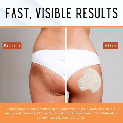 Kisshi™ Butt-Lift Shaping Pads