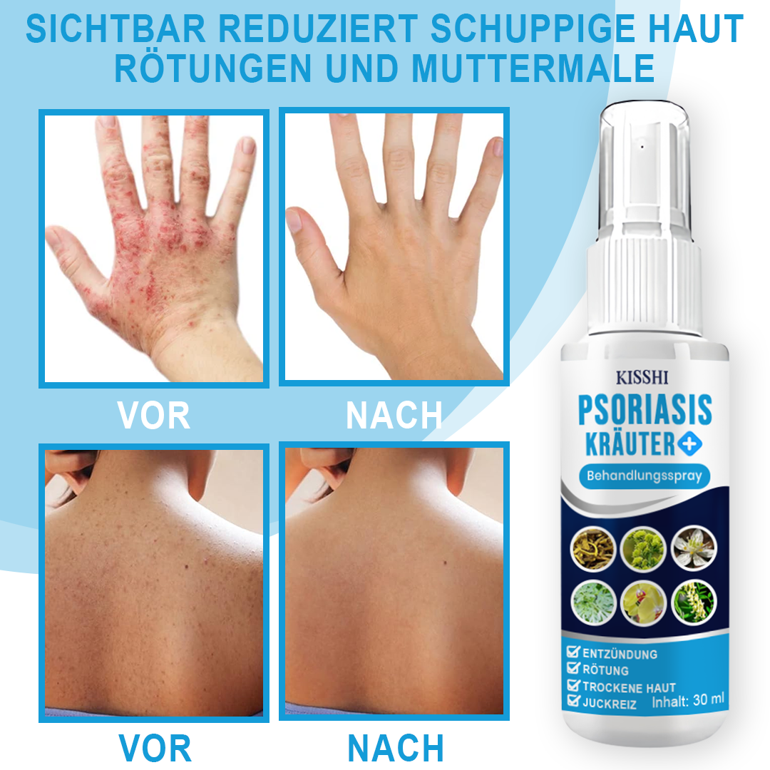 KISSHI™ Psoriasis Kräuter Behandlungsspray