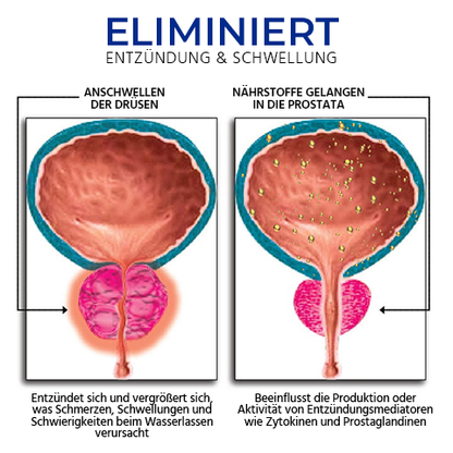 Oveallgo™ EXTRA BeeProsta Nasenspray für die Prostatagesundheit