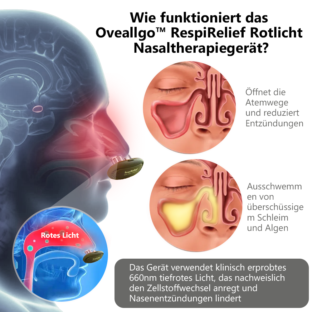 Oveallgo™ INSTANT RespiRelief Rotlicht Nasaltherapiegerät