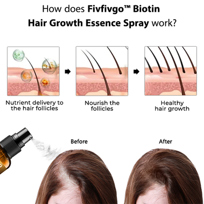 Fivfivgo™ Biotin Haarwuchs Essenz Spray 🔥🔥