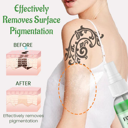 Fivfivgo™ PureSkin Tattoo-Entfernungs-Creme