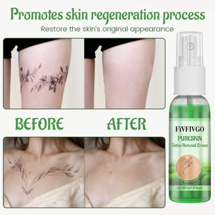 Fivfivgo™ PureSkin Tattoo-Entfernungs-Creme